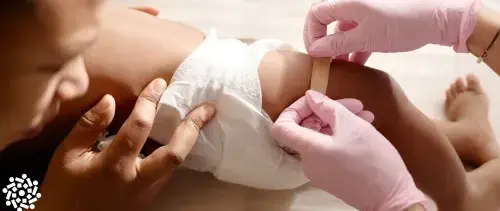 Profissional de saúde coloca curativo em perna de bebê após aplicação da vacina pneumocócica 20-valente