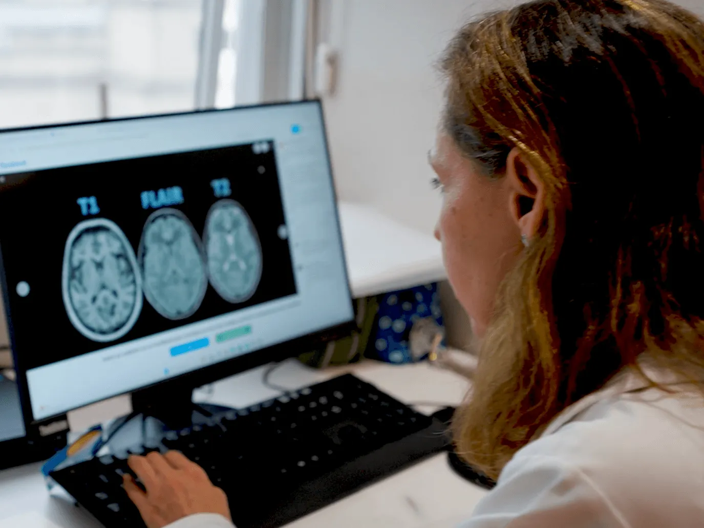 Residência Médica em Neurologia Pediátrica | Sabará-Pensi