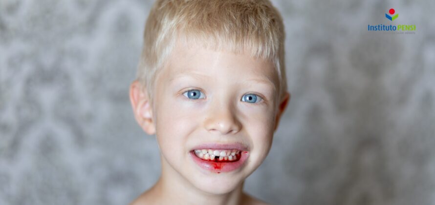 Traumatismo dentário – Parte 1